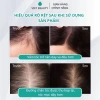 Tinh chất Bio-Placental Scalp Serum VIETBEAUTY - Dưỡng nang tóc, tăng mật độ, giảm rụng tóc - Chỉ 135.000₫ 6