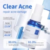 Tinh chất chống mụn lỏng - Loại bỏ mụn trứng cá, giảm đỏ, chống dị ứng, làm dịu da 3