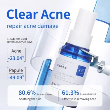 Tinh chất chống mụn lỏng - Loại bỏ mụn trứng cá, giảm đỏ, chống dị ứng, làm dịu da 3 Tinh chất chống mụn lỏng - Loại bỏ mụn trứng cá, giảm đỏ, chống dị ứng, làm dịu da 3