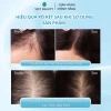 Tinh chất dưỡng nang tóc Bio-Placental Scalp Serum VIETBEAUTY - Tăng mật độ, giảm rụng tóc, giá chỉ 135.000₫ 5