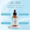 Tinh chất dưỡng nang tóc Bio-Placental Scalp Serum VIETBEAUTY - Tăng mật độ, giảm rụng tóc, giá chỉ 135.000₫ 6