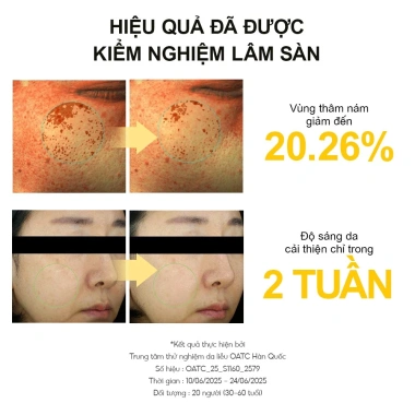 Tinh Chất Dưỡng Sáng Mờ Thâm NINELESS B-Boost 1% Kojic Acid Serum 30ml - Chỉ 434.000₫ 6 Tinh Chất Dưỡng Sáng Mờ Thâm NINELESS B-Boost 1% Kojic Acid Serum 30ml - Chỉ 434.000₫ 6