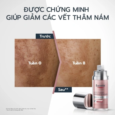 Tinh chất Eucerin Spotless Serum 30ml – Giảm thâm nám, dưỡng sáng