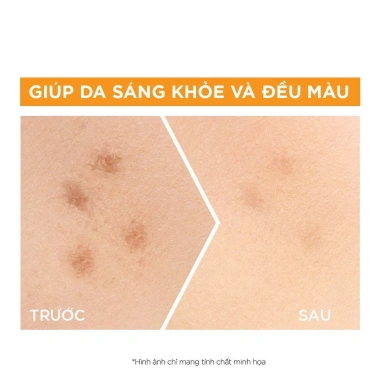 Tinh chất Garnier 4% Niacinamide – Chống mụn, sáng da, Boost Vitamin C, Hyaluron Serum 30ml 7