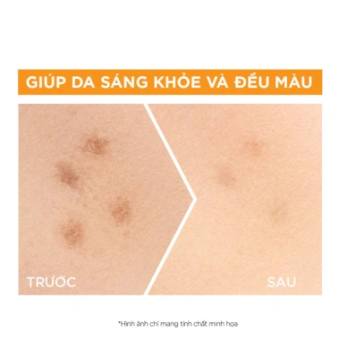 Tinh Chất Garnier Light Complete Vitamin C 30ml - Sáng Da, Mờ Thâm, Tăng Cường Dưỡng 309k 3