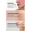 Tinh Chất Giảm Mụn, Mờ Thâm, Làm Dịu Da Skin1.004 Madagascar Centella Ampoule 30ml/55ml/100ml - Giá chỉ 259.000 VND 6
