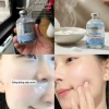 Tinh chất HA Tế bào gốc PDRN 55ml Grasen Hàn Quốc Căng bóng, phục hồi và trẻ hóa da, giảm 22% 7