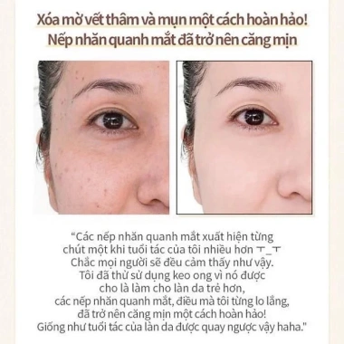Tinh chất keo ong WellDerma Propolis 1.000 - Dưỡng da chống oxy hoá phục hồi - 294.000 2 Tinh chất keo ong WellDerma Propolis 1.000 - Dưỡng da chống oxy hoá phục hồi - 294.000 2