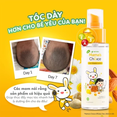 Tinh Chất Kích Thúc Tóc Nhiều, Nuôi Dưỡng Da Đầu Bé Mamas Choice - Không Kích Ứng, Giá 207K
