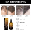 Tinh Chất Mọc Tóc Biotin LUNOON - Xịt Dưỡng Mọc Chắc Khỏe, Bóng Mượt, Giảm Thưa Hói 3