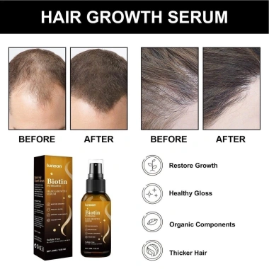 Tinh Chất Mọc Tóc Biotin LUNOON - Xịt Dưỡng Mọc Chắc Khỏe, Bóng Mượt, Giảm Thưa Hói 3