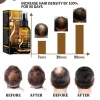Tinh Chất Mọc Tóc Biotin LUNOON - Xịt Dưỡng Mọc Chắc Khỏe, Bóng Mượt, Giảm Thưa Hói 7