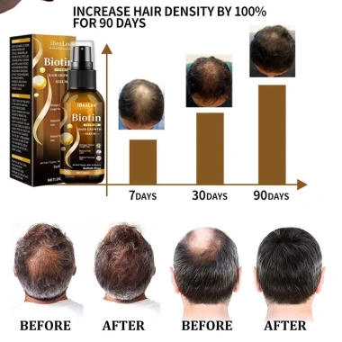 Tinh Chất Mọc Tóc Biotin LUNOON - Xịt Dưỡng Mọc Chắc Khỏe, Bóng Mượt, Giảm Thưa Hói 7