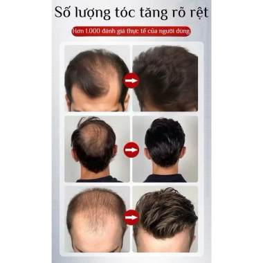 Tinh Chất Móc Tóc Greenvibes Thảo Dược 30ml - Xịt Nuôi Dưỡng, Giảm Rụng Tóc Bạc, Giá 132.000₫ 6