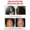 Tinh Chất Mọc Tóc Nhân Sâm SKINZE CQRZEN - Xịt Kích Mọc, Giảm Rụng, Hói Đầu, Dưỡng Nang Tóc Chắc Khỏe 129k 3
