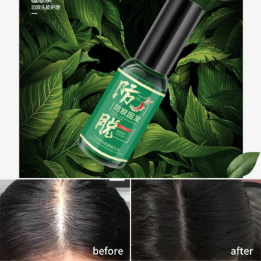 Tinh Chất Mọc Tóc Nhân Sâm SKINZE CQRZEN - Xịt Kích Mọc, Giảm Rụng, Hói Đầu, Dưỡng Nang Tóc Chắc Khỏe 129k