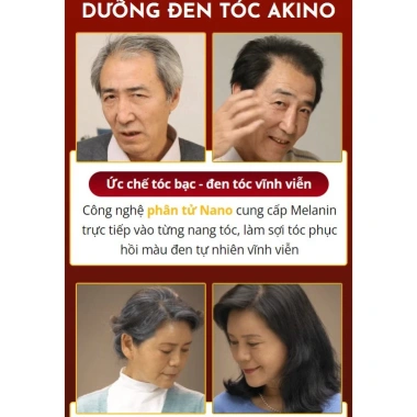 Tinh chất Nấm Linh Chi AKINO - Dưỡng tóc, kích đen, giảm bạc, tăng độ dày, giá 109.333đ 2