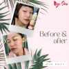 Tinh Chất Ngọc Sâm Ngừa Mụn Thâm, Làm Trắng Da 10ml - Thảo Dược - Giá 70.000 VND 5