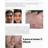 Tinh chất Niacid Slurp 100% chính hãng - Phục hồi sẹo mụn, giảm thâm, 600.000đ 5