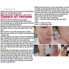 Tinh chất Niacid Slurp 100% chính hãng - Phục hồi sẹo mụn, giảm thâm, 600.000đ 7