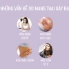 Tinh chất ốc sên giảm sẹo, làm mờ vết rạn da sau sinh - Giá chỉ 37.688 VND 4