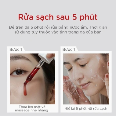 Tinh chất Peel Da Heimish RX AHA BHA Wash Off 35ml - Giảm Giá Đặc Biệt 458k