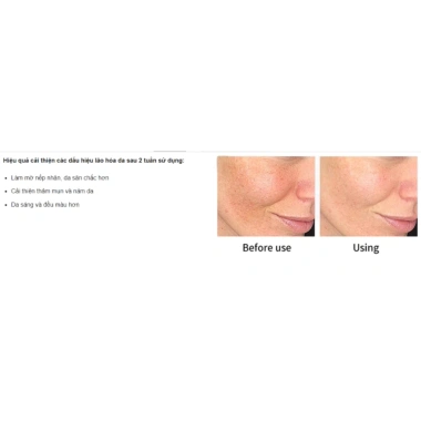 Tinh Chất Pharmaform Smoothing 10% AHA - Làm Sáng Trẻ Hóa Da 30ml | Xink Skinlab 9
