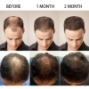 Tinh chất Polypeptide tăng mật độ tóc Follicle 60ml - Bảo trì tóc, nuôi dưỡng da đầu, giảm rụng, giá ưu đãi 108.900₫ 6