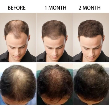 Tinh chất Polypeptide tăng mật độ tóc Follicle 60ml - Bảo trì tóc, nuôi dưỡng da đầu, giảm rụng, giá ưu đãi 108.900₫ 6