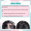 Tinh chất Sato chấm hói giảm rụng tóc 30ml Nhật Bản, hiệu quả nhanh, giá 119k 8