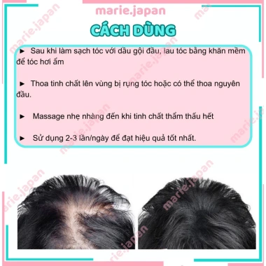 Tinh chất Sato chấm hói giảm rụng tóc 30ml Nhật Bản, hiệu quả nhanh, giá 119k