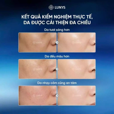 Tinh Chất Serum Black Ginseng Nhân Sâm Đen - Làm Trắng Da, Cải Thiện Thâm Sạm, Chống Lão Hóa - Giá 169.000 VNĐ 5