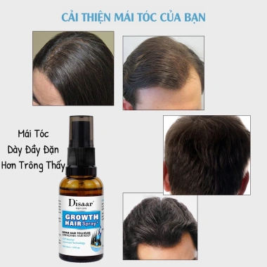Tinh Chất Thảo Dược Disaar - Kích Thích Mọc Tóc, Phục Hồi Hư Tổn, Chỉ 42.930₫ 4