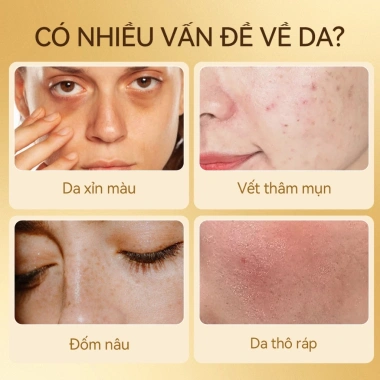 Tinh chất Toner Vitamin C Niacinamide Lanbena – Trắng sáng, giảm thâm, săn chắc da