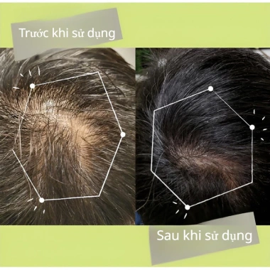 Tinh chất Usmania - Dưỡng tóc & lông mày, 100% thảo dược, tăng mọc mày 99k 4