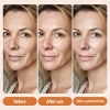 Tinh chất Vitamin C Lakerain 50ml – Sáng da, trẻ hóa, bổ sung Collagen, giảm nếp nhăn 4