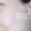 Tinh chất Vitamin C OHUI Genummune Ampoule - Dưỡng sáng da, chống lão hoá, 577.000 VND 6