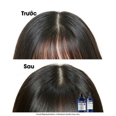 Tinh chất xịt Serioxyl Advanced 90ml - Tăng mật độ, làm dày tóc thưa, giảm giá 5