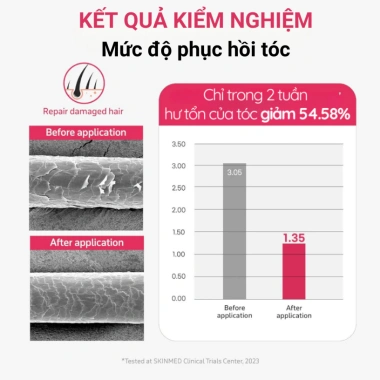 Tinh Dầu Phục Hồi Tóc Hư Tổn Probiotics Dr. Bio Pink - Dưỡng ẩm, Giúp mọc tóc, Giá ưu đãi 456.000đ 200ml 3