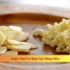 Tỏi Củ Kinh Môn Loại 1 Đã Chọn Lọc - Củ to, chắc, mẩy, chuẩn vị - Giá ưu đãi 68.000đ | ANH BÉO NÔNG SẢN 5