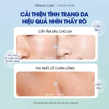 TONER DƯỠNG ẨM NIACINAMIDE 500ml Cân Bằng Da, Phục Hồi Đa Tầng, Dưỡng Sáng - 199k