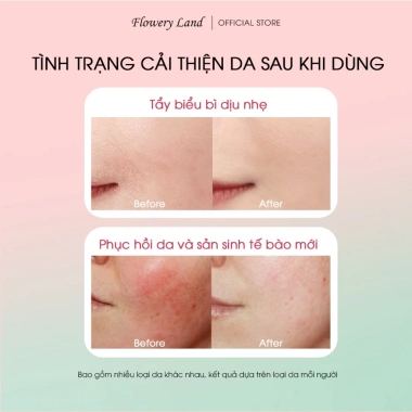 Toner Pad Collagen & Peptide FLOWERY LAND 170g - Tăng đàn hồi, trẻ hóa, cấp ẩm, nâng cơ vùng cằm 3