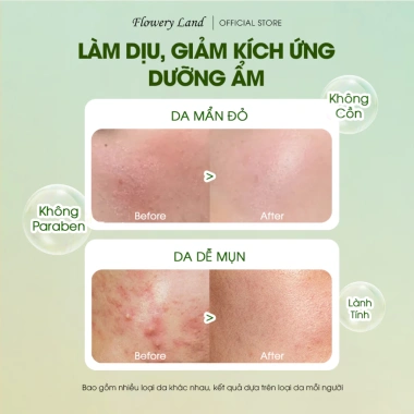 Toner Pad Flowery Land CICA B5 70 miếng 180g - Dưỡng ẩm, làm dịu, cân bằng da nhạy cảm giảm đỏ, giảm giá 350.900 VND 2