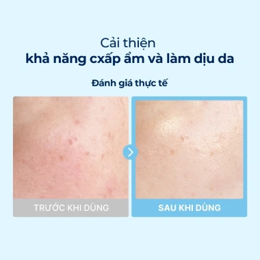 Torriden Pad đa năng DIVE IN Hyaluronic Acid 80 miếng Toner Pad dưỡng ẩm giảm nếp nhăn giá ưu đãi 328.900₫ 3