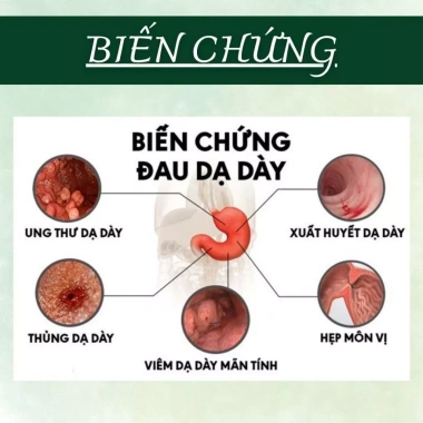 Trà Dạ Dày Đại Tràng 50 lọc - Giảm viêm loét, trào ngược, ợ hơi, ợ chua, ngăn HP - Giá 130.000₫