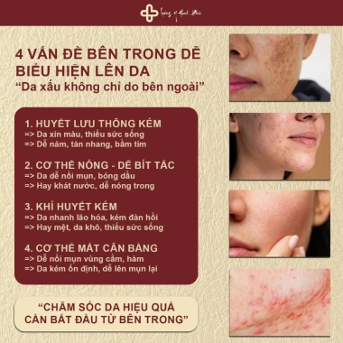 Trà Dưỡng Nhan Thanh Lọc - Cân Bằng Nội Tiết, Dưỡng Da, Sáng Da, Chống Lão Hóa - 166.300₫ 2 Trà Dưỡng Nhan Thanh Lọc - Cân Bằng Nội Tiết, Dưỡng Da, Sáng Da, Chống Lão Hóa - 166.300₫ 2