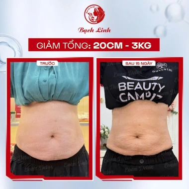 Trà Eoem 1.990 Duyên Thị 15 gói - Eo Đẹp, Dáng Xinh, Thanh Nhiệt, Giải Độc, 580.000₫ 8