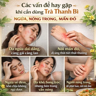 Trà giải độc da Thanh Bì - Trị mụn, viêm da, cơ địa, thanh nhiệt, mát gan, cải thiện da - Giá ưu đãi 185.000 VND 2