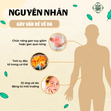 Trà Thải Độc Da Bội Lan Đường - Giảm ngứa, chữa viêm da cơ địa, chàm, nấm - Túi 50 lọc, Giá ưu đãi 154,000đ