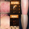 Trà Thải Độc Da Bội Lan Đường - Giảm ngứa, chữa viêm da cơ địa, chàm, nấm - Túi 50 lọc, Giá ưu đãi 154,000đ 7